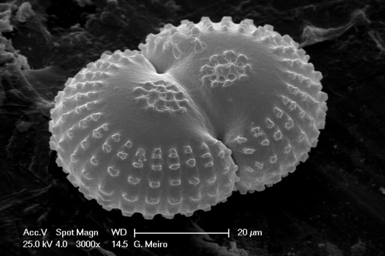 [03/10] Limitaciones y bondades de la microscopía electrónica de transmisión en el estudio de materiales